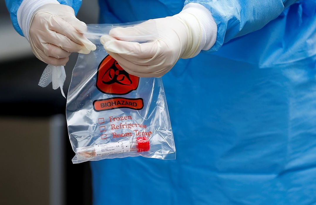 Covid: por que os casos na China estão aumentando? - teste coronavirus2603200043 e1647295684615